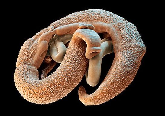Schistosome