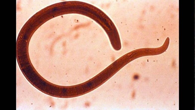 Tricinella